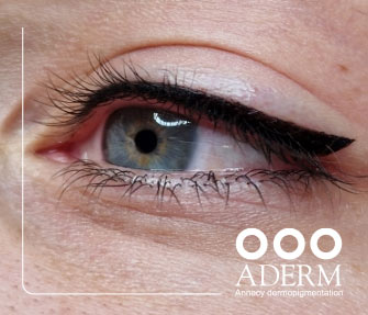 Eye-liner - Centre ADERM, Annecy