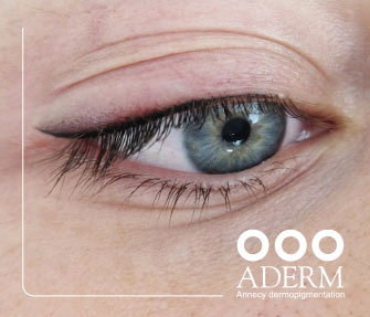 Eye-liner - Centre ADERM, Annecy