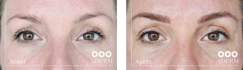 Maquillage permanent - Centre ADERM - Annecy